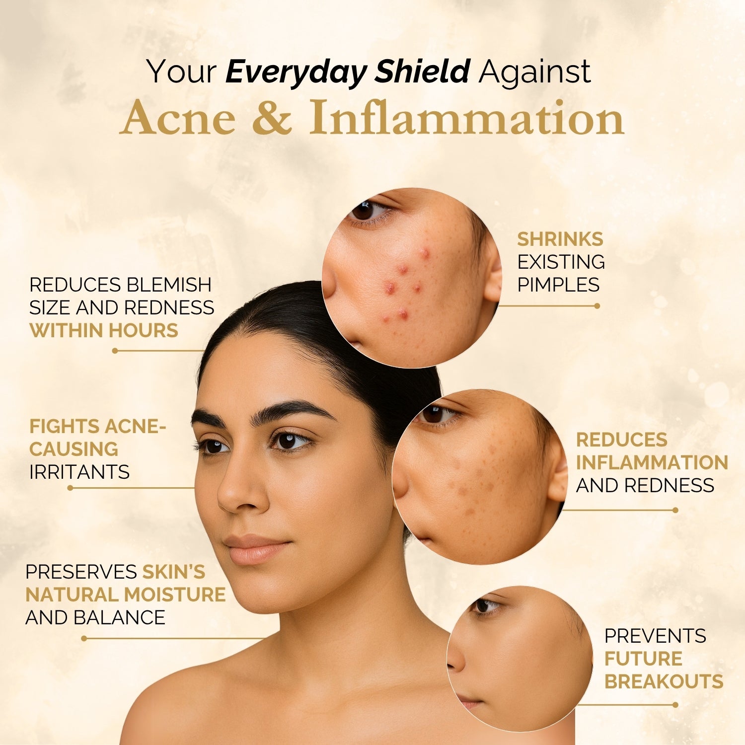 Exotic Aromas Anti-Acne Face Serum
