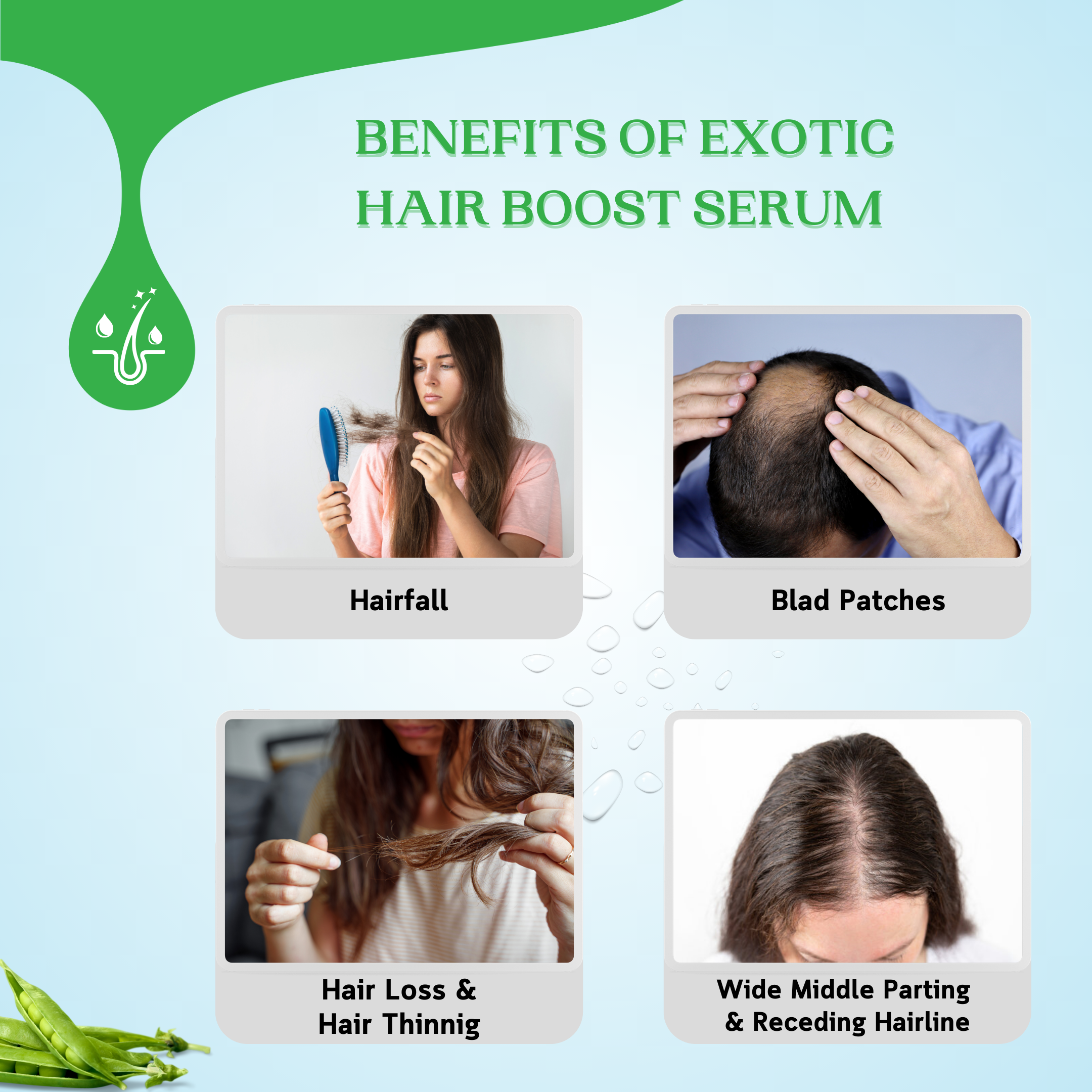 Exotic Aromas-Exotic Hair Boost Serum with 3% Redensyl, 3% Rosemary, 4% Anagain & 4% Biacapil, 30 ML, for hair loss, hair growth, thinning, baldness, for thicker & denser Hair. For Men & Women-30ML